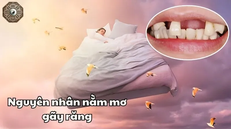 Mơ thấy gãy răng có ý nghĩa gì? Khám phá những điềm báo bí ẩn  1