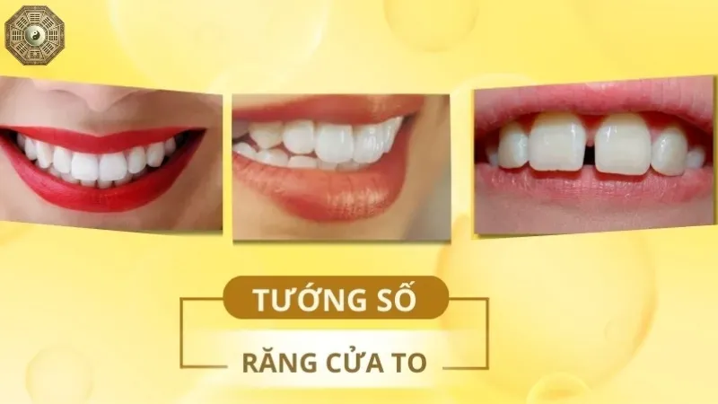 Nhân tướng học răng - Cách nhận biết tính cách qua răng miệng 1