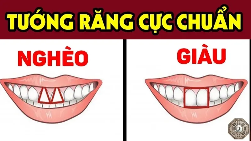 Nhân tướng học răng - Cách nhận biết tính cách qua răng miệng 4