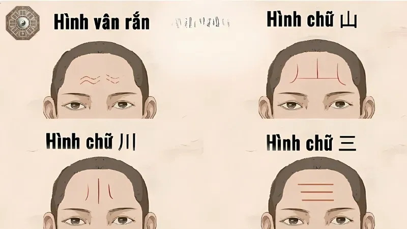 Tướng trán trong nhân tướng học - Dấu hiệu tính cách và vận mệnh 3