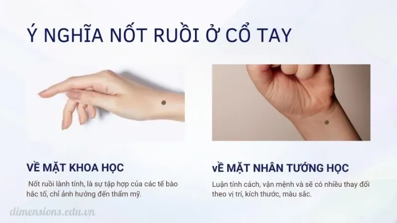 Tìm hiểu nhân tướng học nốt ruồi trên tay qua từng vị trí 3