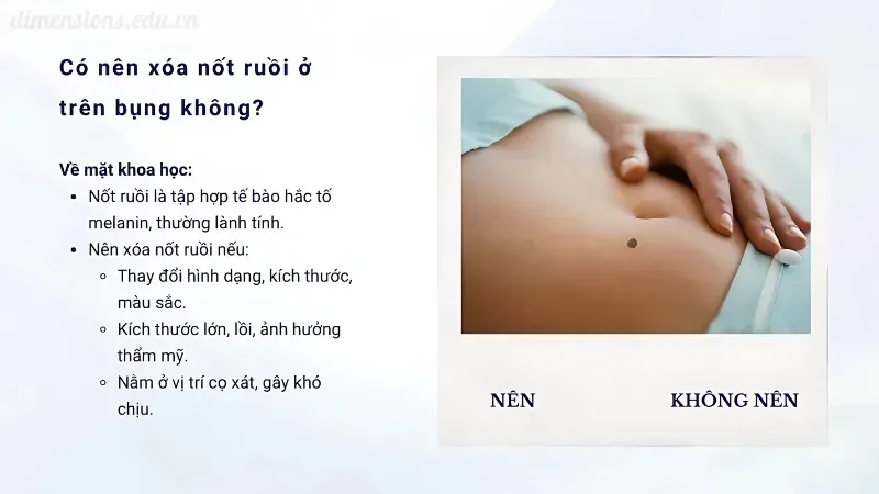 Có nên xóa nốt ruồi ở bụng?