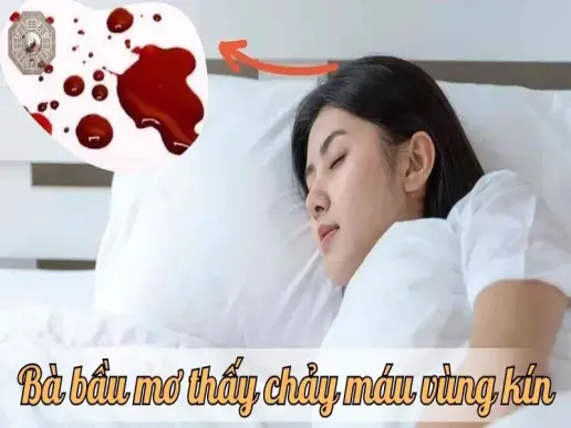 Bà bầu nằm mơ thấy chảy máu vùng kín nên làm gì để giảm lo âu?