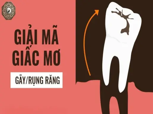 Mơ thấy gãy răng có ý nghĩa gì? Khám phá những điềm báo bí ẩn