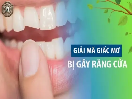 Giấc mơ gãy răng cửa là điềm gì? Những tín hiệu cảnh báo quan trọng