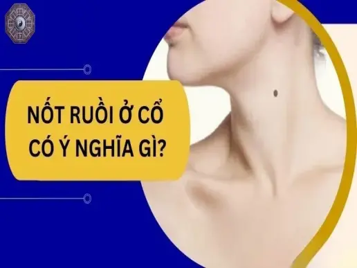 Tướng số nốt ruồi ở cổ - Giải mã vận mệnh giàu sang, phú quý