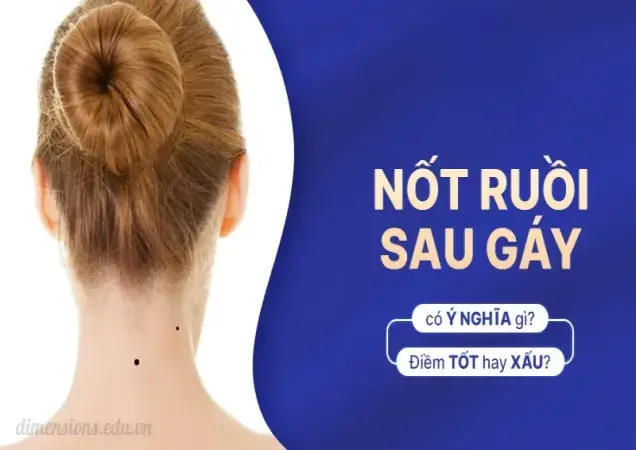 Giải mã tướng số nốt ruồi sau gáy - May mắn hay xui xẻo?