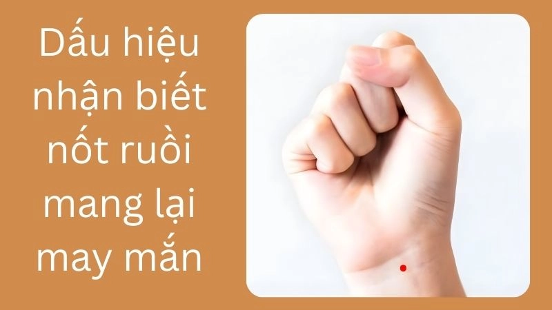 Dấu hiệu nhận biết nốt ruồi mang lại may mắn hay không 