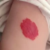 Giải mã ý nghĩa vết bớt đỏ trên đầu theo nhân tướng học