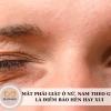 Mắt Phải Giật Là Điềm Báo Gì? Giải Mã Hiện Tượng Theo Khoa Học và Tâm Linh