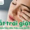 Mắt trái nam giật là điềm gì? Giải mã theo giờ và góc nhìn khoa học