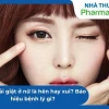 Nháy mắt phải ở nữ có điềm gì? Giải mã điềm báo và góc nhìn khoa học