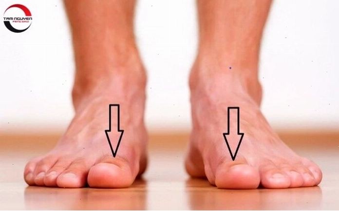 Bàn chân có ngón cái dài nhất thể hiện sự mạnh mẽ và quyết đoán