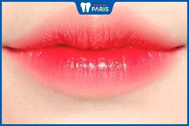 Đàn ông có tướng môi chẻ