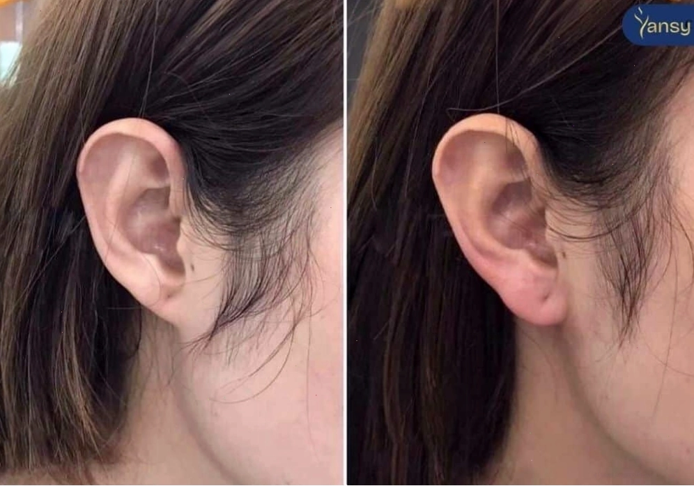 Dáng tai tài lộc mang lại vận mệnh tốt đẹp cho phụ nữ