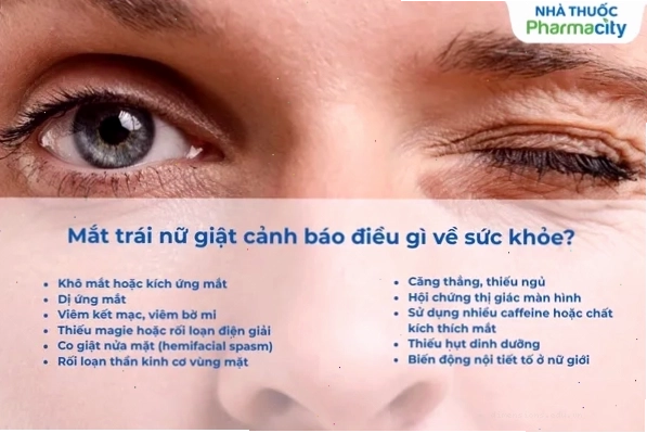 Mắt trái nữ giật cảnh báo bệnh gì