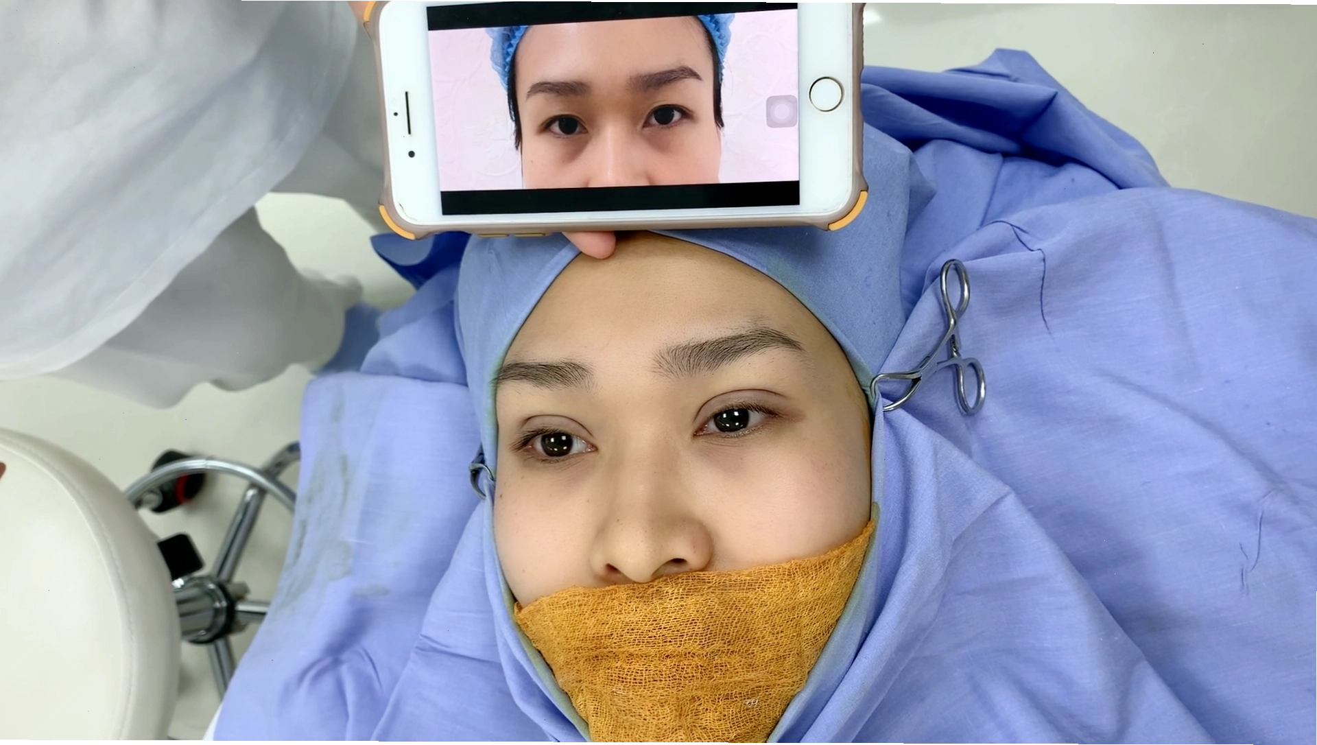 Nâng mí mắt kết hợp chỉnh sửa dáng mày