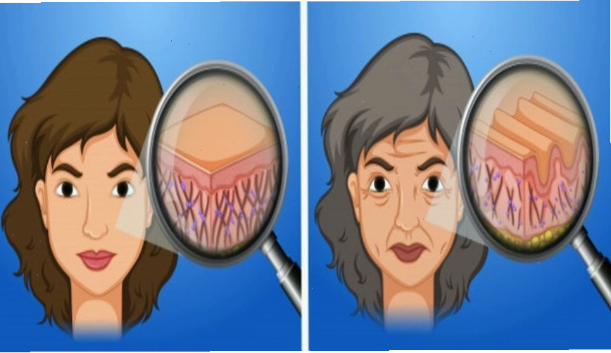 Nếp nhăn ở miệng do lão hóa da và các yếu tố bên ngoài