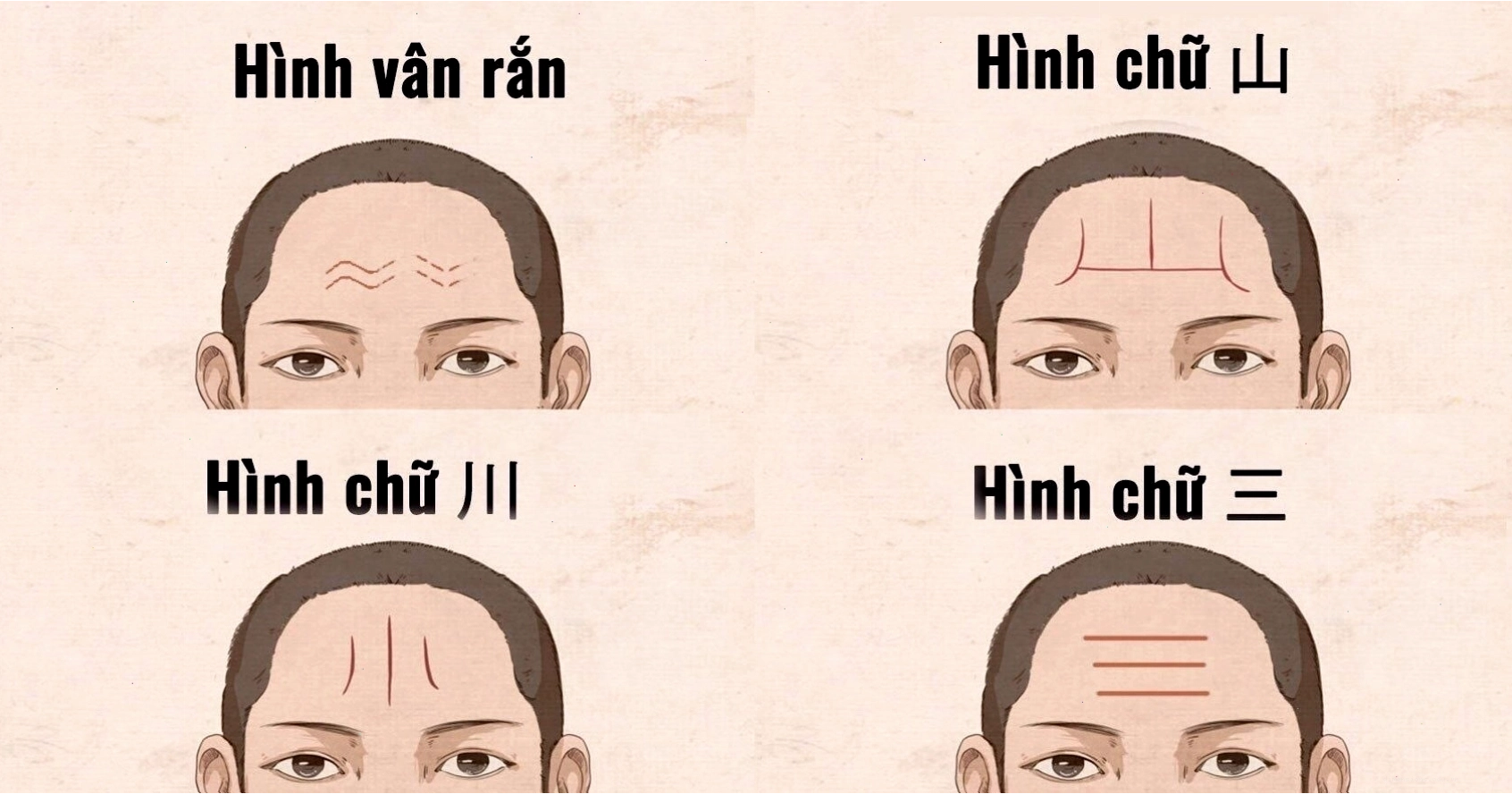 Nếp nhăn tướng trán và ý nghĩa trên khuôn mặt