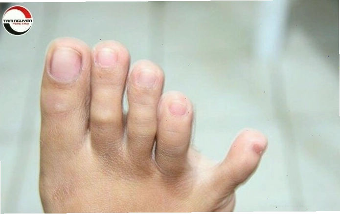 Ngón chân út dài nhất thể hiện sự yêu thích tự do và khám phá