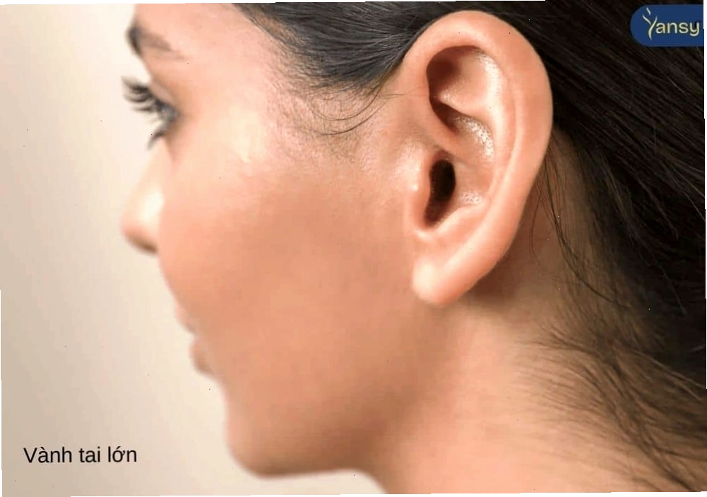 Người có vành tai lớn thường thông minh và rộng lượng