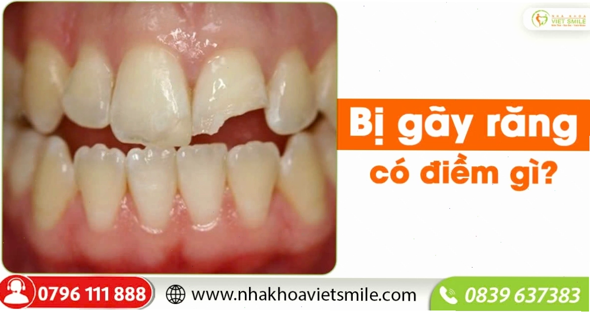Nha khoa VIET SMILE cung cấp các dịch vụ chăm sóc răng miệng chuyên nghiệp