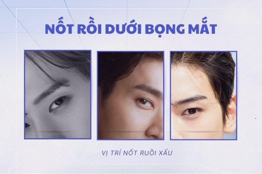 Nốt ruồi trên mũi đàn ông