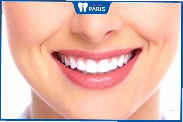 Phụ nữ có tướng răng khít, đều và đẹp thường có cuộc sống sung túc