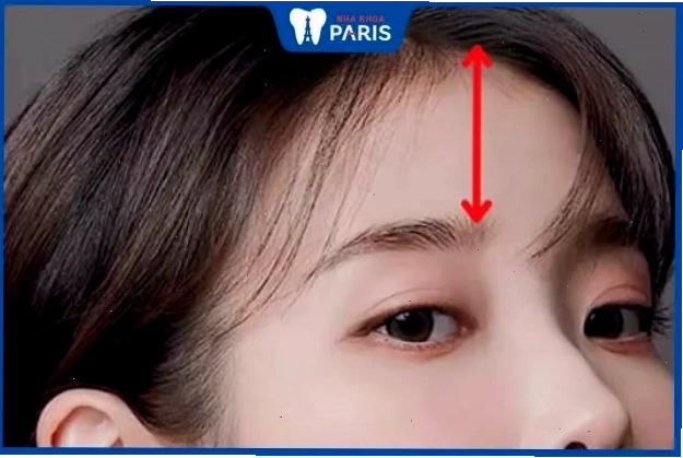 Phụ nữ có tướng trán thấp và hẹp thường cẩn trọng và thực tế