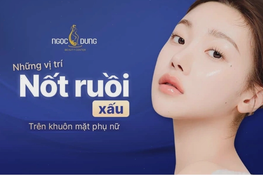 Phụ nữ sở hữu nốt ruồi ở vị trí không tốt cần cân nhắc các giải pháp hóa giải