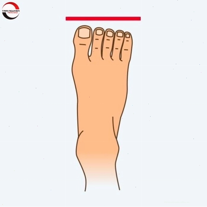 Quan sát cả hai bàn chân để có đánh giá toàn diện về tướng ngón chân