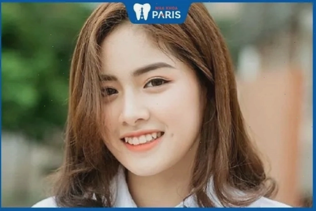 Răng khểnh mang lại nụ cười duyên dáng và may mắn trong tình duyên