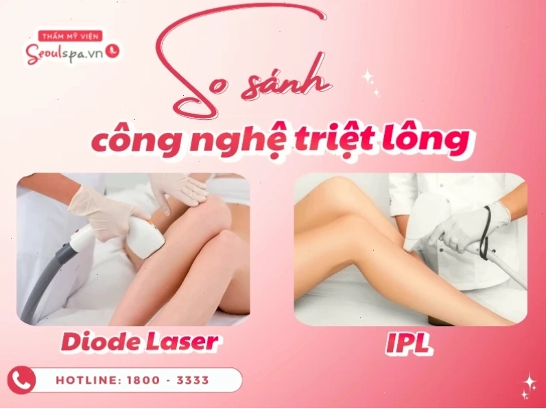 So sánh công nghệ triệt lông Diode Laser và IPL