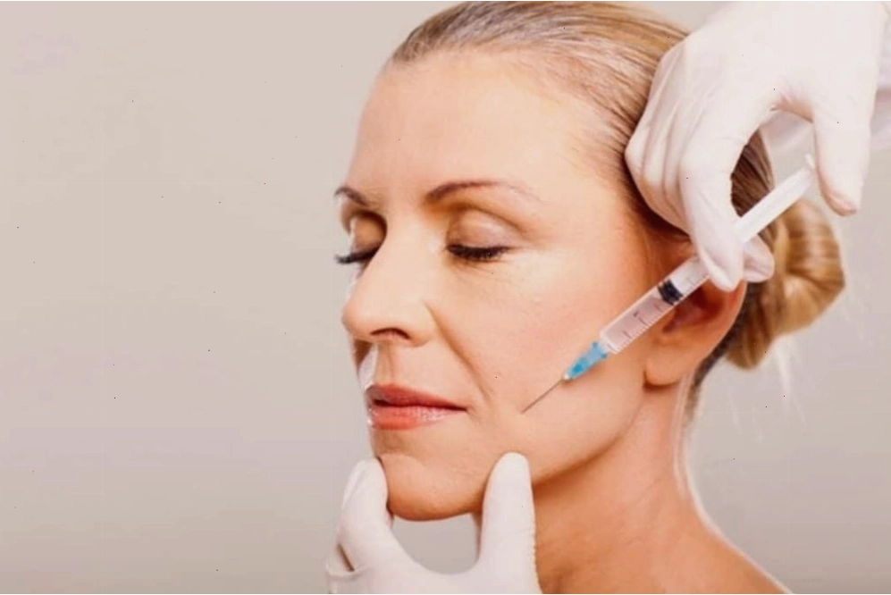 Tiêm Botox cải thiện nếp nhăn khóe miệng - một phương pháp thẩm mỹ phổ biến