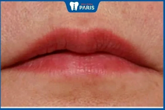 Tướng môi thuyền úp trong nhân tướng học