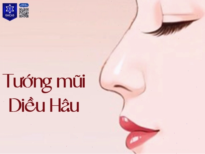 Tướng mũi két với đầu mũi khoằm xuống