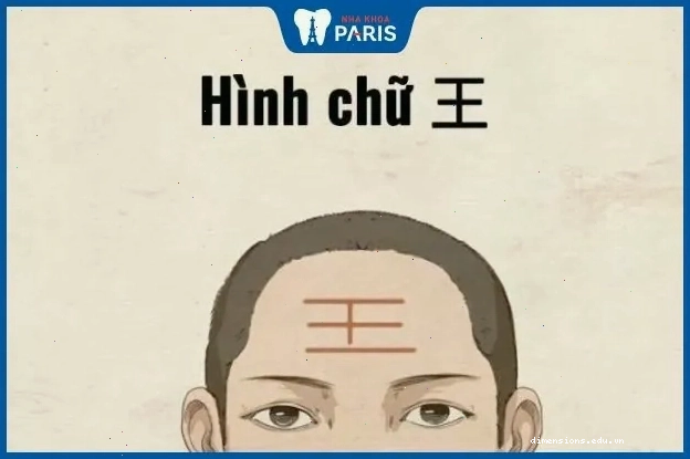 Tướng trán vuông chữ điền thể hiện sự thông minh và ý chí