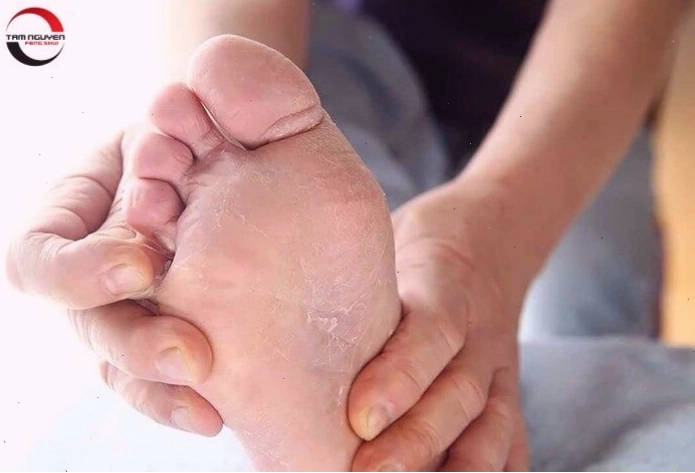 Xem tướng bàn chân nữ lõm và gót chân
