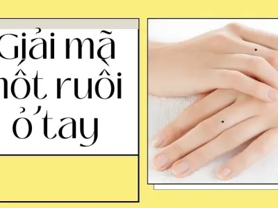 Giải mã nốt ruồi ở tay và bí ẩn về giàu sang nghèo khổ