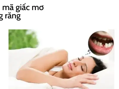 Trải nghiệm giải mã giấc mơ thấy rụng răng và cái kết bất ngờ