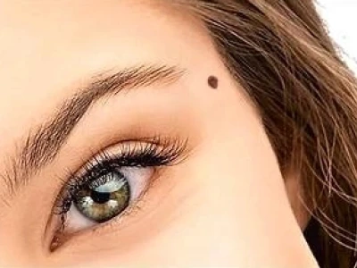 Giải Mã Nốt Ruồi Trên Mặt Phụ Nữ: Tướng Số & Ý Nghĩa