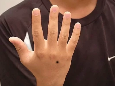 Giải mã nốt ruồi trên mu bàn tay nữ: Tướng số và vận mệnh