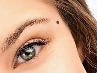 Giải Mã Tướng Số: Xem Nốt Ruồi Trên Mặt Đàn Bà Tốt Xấu