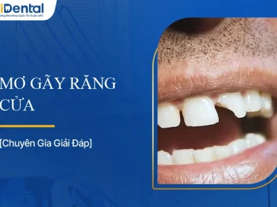 Mơ thấy gãy răng là điềm báo gì? Giải mã giấc mơ chi tiết 2026