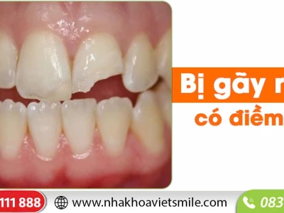 Rụng răng là điềm gì? Giải mã giấc mơ và ý nghĩa tâm linh