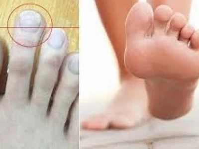 Xem Tướng Bàn Chân Nam Giới: Đoán Vận Mệnh Giàu Sang, Quý Nhân